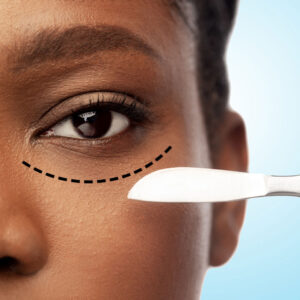 Polynucleotide under eyes - £180.00