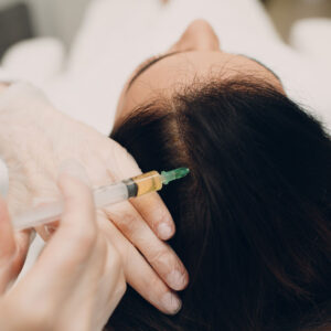 PRF HAIR PACKAGE - £1,100.00