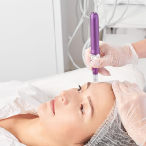NUE REVIVE - FACIAL YEARLY SUBSCRIPTION including botox - £170.00