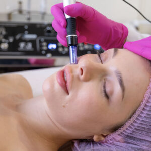 CHEMICAL PEEL - £135.00