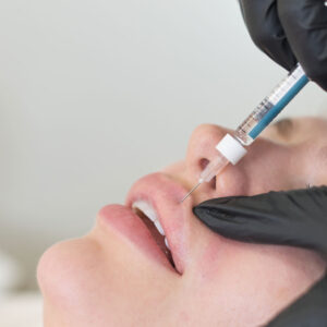 Dermal Filler Dissolving - £100.00