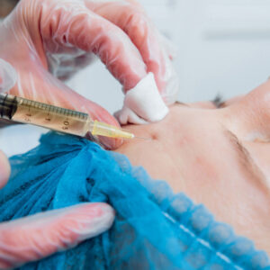 Seventy hyal 2000 x 3 - £350.00